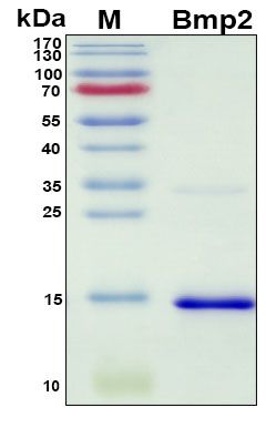 SDS-PAGE