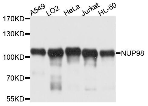 Western blot - NUP98 Polyclonal Antibody (144-00530)