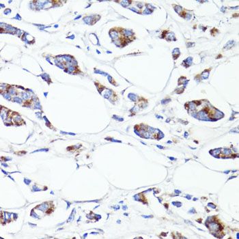 Immunohistochemistry - S100A10 antibody (144-60742)