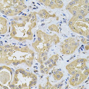 Immunohistochemistry - SPTLC1 Antibody (144-06750)