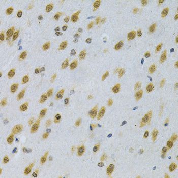 Immunohistochemistry - ELAVL1 Polyclonal Antibody (144-01608)