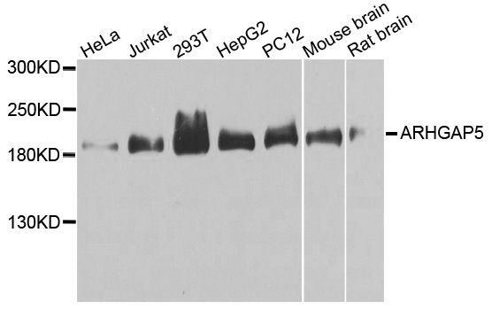 Western blot - ARHGAP5 Polyclonal Antibody (144-03587)