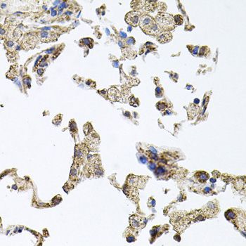 Immunohistochemistry - PKN1 Polyclonal Antibody (144-00553)