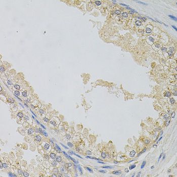 Immunohistochemistry - NAPA antibody (144-07946)