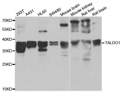 Western blot - TALDO1 antibody (144-013551)