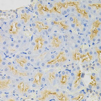 Immunohistochemistry - SYK Antibody (144-02123)