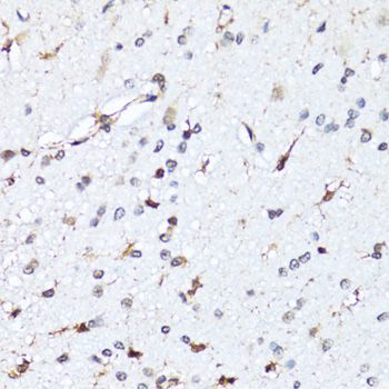 Immunohistochemistry - HIST2H2BE antibody (144-01958)