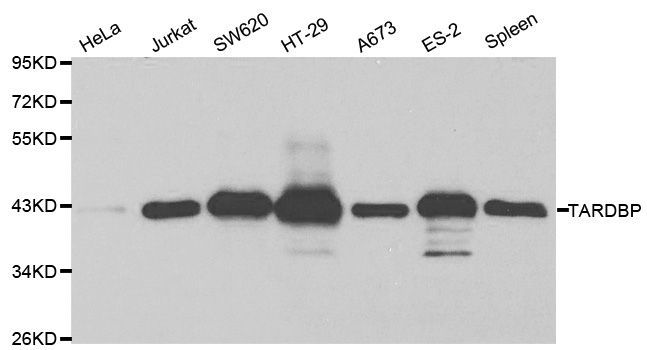 Western blot - TARDBP Polyclonal Antibody (144-01183)