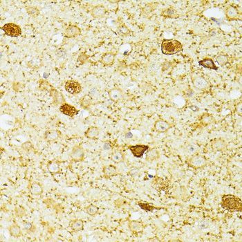 Immunohistochemistry - PVALB antibody (144-60383)