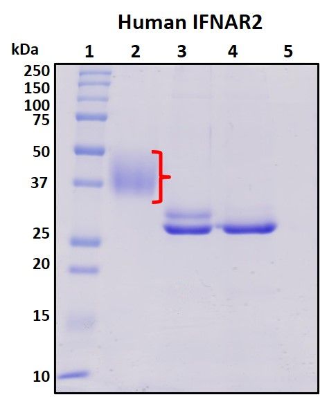 SDS-PAGE