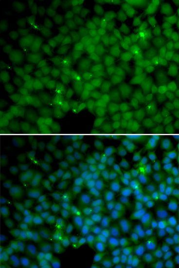 Immunofluorescence - GGH Polyclonal Antibody (144-05464)