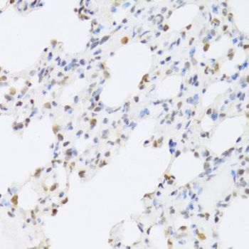 Immunohistochemistry - SFN Polyclonal Antibody (144-01026)