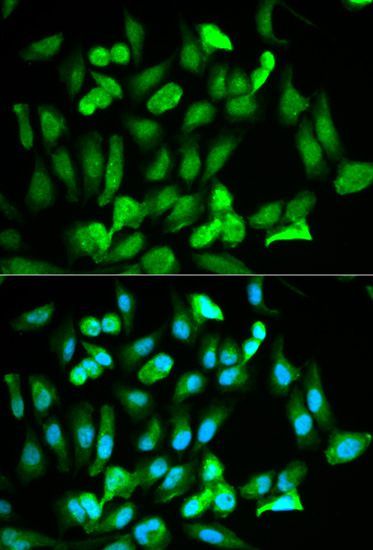 Immunofluorescence - ERG antibody (144-01240)