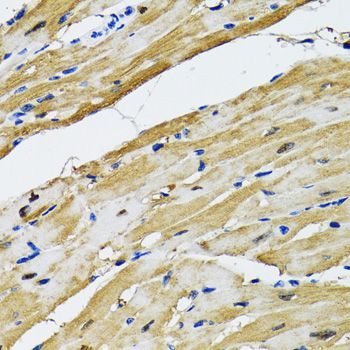 Immunohistochemistry - GOT1 Polyclonal Antibody (144-05822)