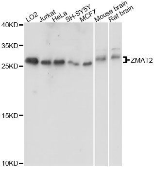 Western blot - ZMAT2 antibody (144-60648)