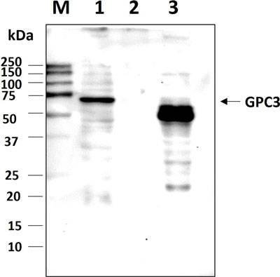 Western blot