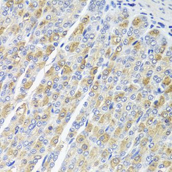 Immunohistochemistry - OSGEPL1 antibody (144-08022)