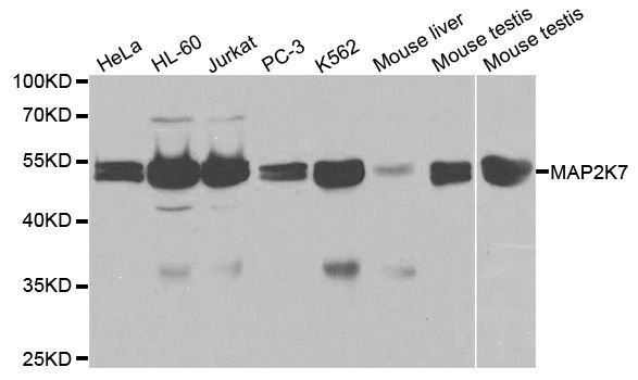 Western blot - MAP2K7 Polyclonal Antibody (144-02186)