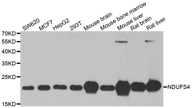 Western blot - NDUFS4 Polyclonal Antibody (144-06390)