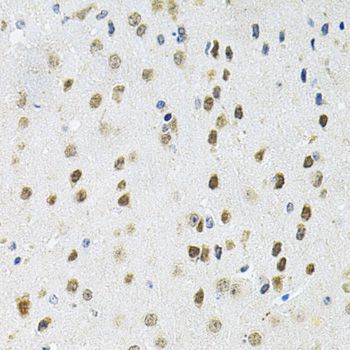 Immunohistochemistry - PPP1CA Polyclonal Antibody (144-12468)
