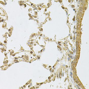 Immunohistochemistry - PSMA5 Antibody (144-60567)