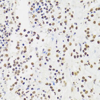 Immunohistochemistry - XRCC6 Polyclonal Antibody (144-00883)