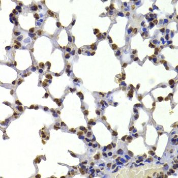 Immunohistochemistry - CBX5 antibody (144-12577)
