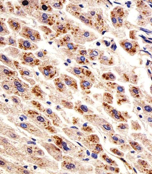 IHC-P