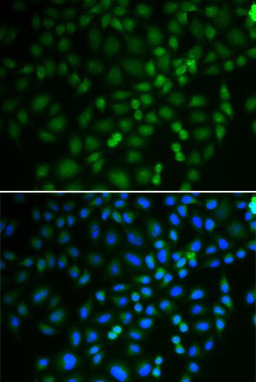 Immunofluorescence - TRIM21 antibody (144-013547)