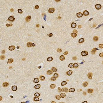Immunohistochemistry - Lamin A/C Polyclonal Antibody (144-00249)