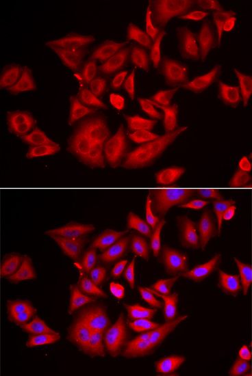 Immunofluorescence - TLK2 antibody (144-06770)