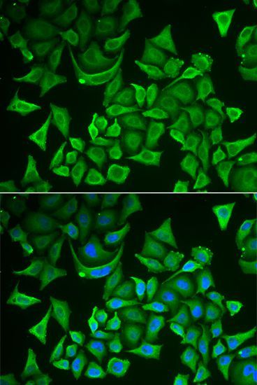 Immunofluorescence - DTYMK antibody (144-06370)