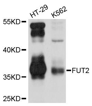 Western blot - FUT2 Polyclonal Antibody (144-05721)