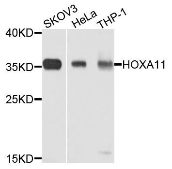 Western blot - HOXA11 Polyclonal Antibody (144-02976)
