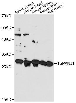 Western blot - TSPAN31 antibody (144-014256)