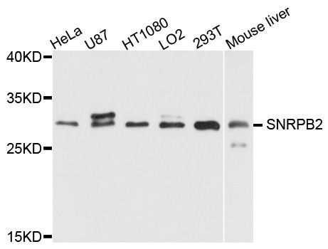 Western blot - SNRPB2 antibody (144-08908)