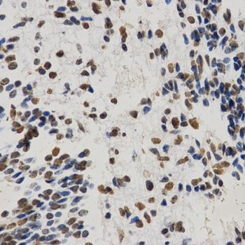 Immunohistochemistry - MonoMethyl-Histone H3-K9 pAb (144-02358)