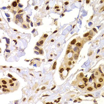 Immunohistochemistry - HNRNPA1 Polyclonal Antibody (144-07491)