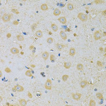 Immunohistochemistry - CAMK1G Antibody (144-07379)