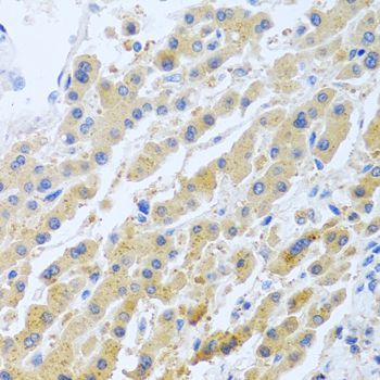 Immunohistochemistry - STC1 antibody (144-06755)