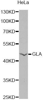 Western blot - GLA antibody (144-60540)