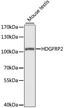 Western blot - HDGFRP2 antibody (144-07484)