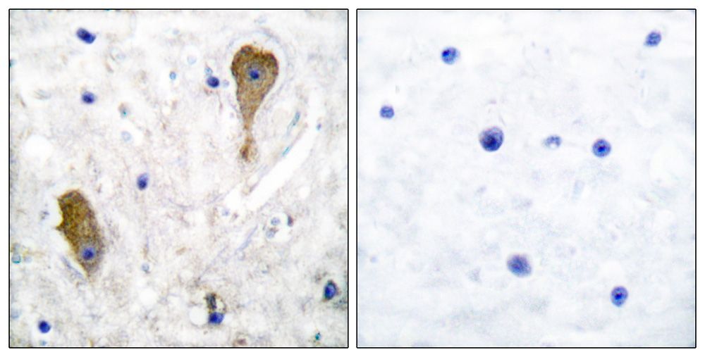IHC