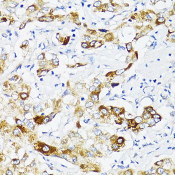 Immunohistochemistry - FN1 antibody (144-12932)