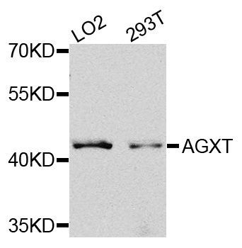 Western blot - AGXT antibody (144-08397)