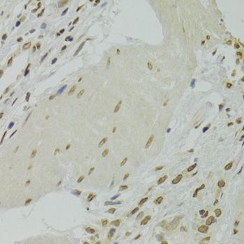 Immunohistochemistry - XRCC6 Polyclonal Antibody (144-00883)