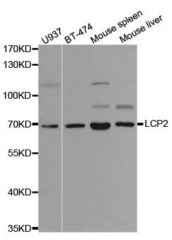 Western blot - LCP2 antibody (144-02567)