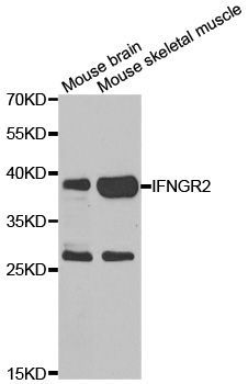 Western blot - IFNGR2 Polyclonal Antibody (144-07558)