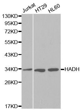 Western blot - HADH Polyclonal Antibody (144-01076)