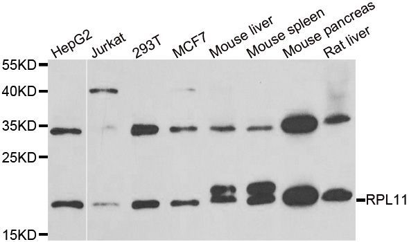 Western blot - RPL11 antibody (144-06407)